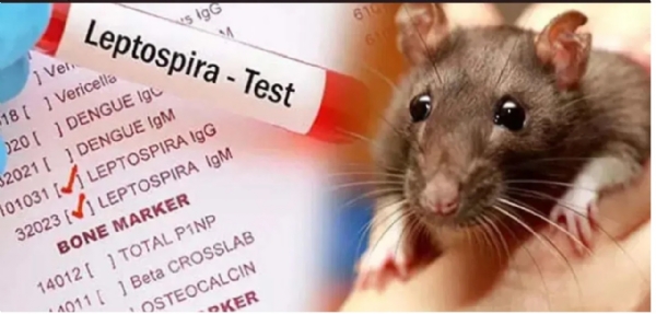 रैट फीवर रैट फीवर