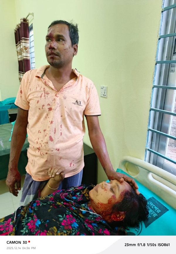 बांग्लादेश