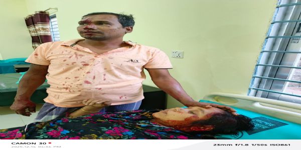 বাংলাদেশঃ কাছিমপুৰত ভাড়াতীয়া পৰিয়ালত নৃশংস আক্ৰমণ, আহত তিনিজন