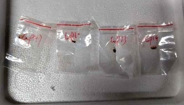 यही है वह खतरनाक जहरीला फंगस। इन पैकेटों को सीलबंद लिफाफे में संघीय अदालत को सौंपा गया है।